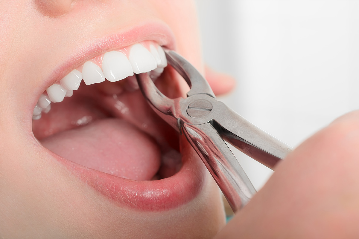What is the Difference Between General Dentistry and Cosmetic Dentistry?