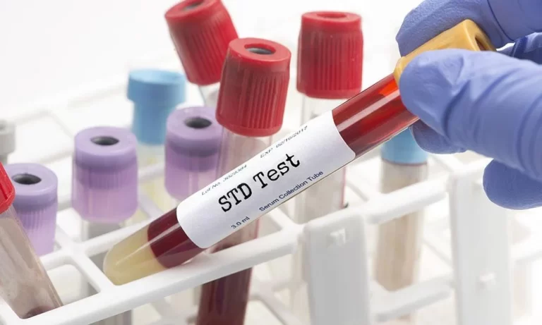 Fast and convenient: Obtain an at-home STD test to put your mind at ease