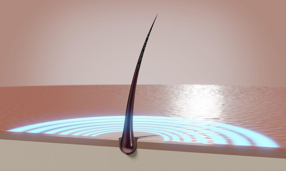 3 Facts About What Permanent Hair Removal Really Means in Clinical Settings