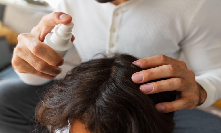 Oily Scalp Treatment in Singapore: Tips for Daily Care