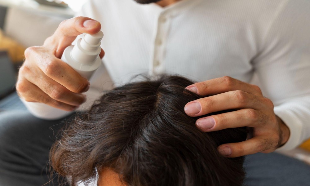 Oily Scalp Treatment in Singapore: Tips for Daily Care